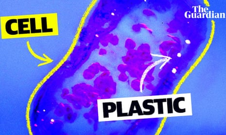 How plastics are invading our brain cells