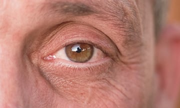 Closeup of a man's eye with short eyelashes